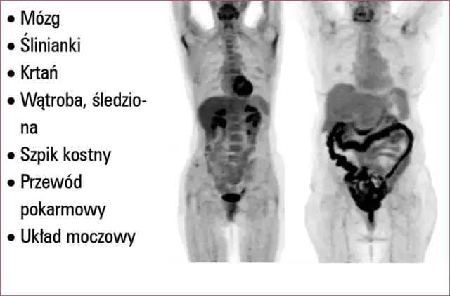 Jak długo czekać na wynik badania PET i jak go odebrać?
