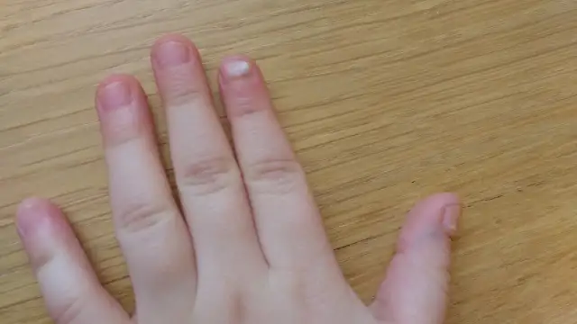 Czy po bostonce schodzą paznokcie? Zaskakujące skutki uboczne!