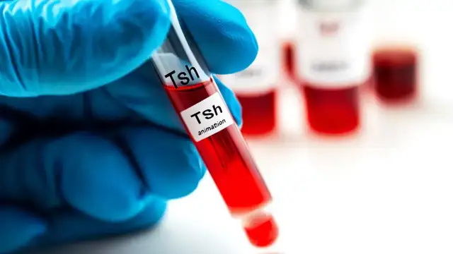 TSH: Co to za badanie? Wyniki, normy, objawy pełny przewodnik