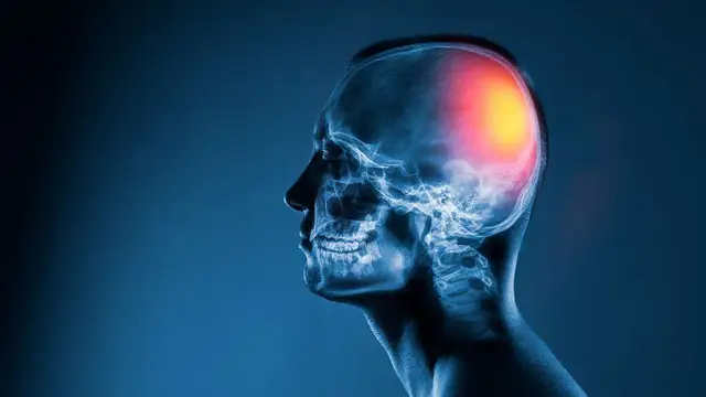 Leki na migotanie przedsionków: Skuteczne leczenie i zapobieganie udarom