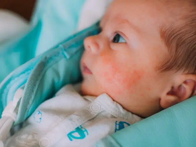 Objawy przegrzania niemowlaka – jak je rozpoznać i co zrobić?