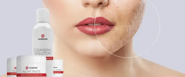 Jakie kosmetyki na trądzik skutecznie zwalczają niedoskonałości?