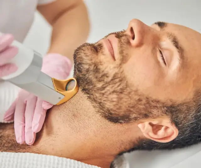 Trwała gładkość brody: ile zabiegów laserem? Odpowiedź eksperta.