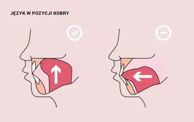 Prawidłowa pozycja języka: Jak ćwiczyć i dlaczego to ważne?