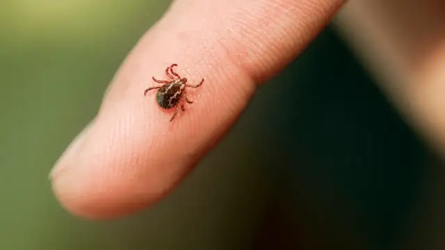 Kleszcz na palcu ludzkim, zbliżenie.