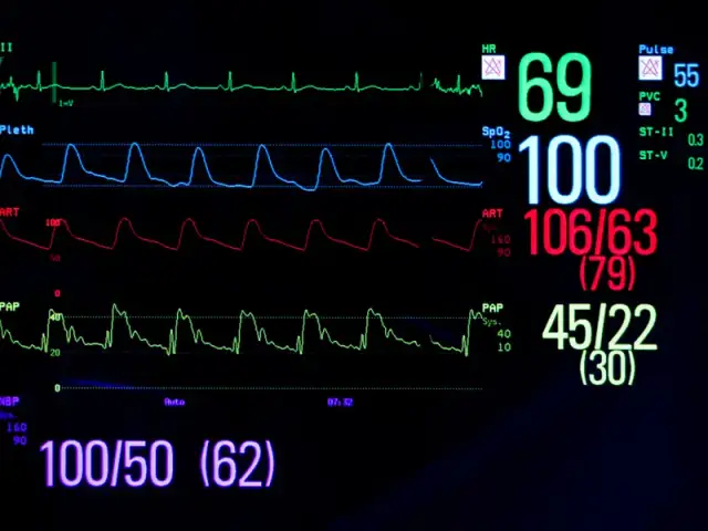Prawidłowy puls podczas snu: Co mówią normy i objawy?