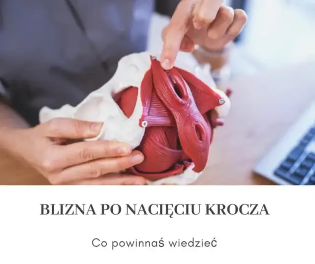 Jak dbać o krocze po porodzie: skuteczne sposoby na szybsze gojenie i komfort