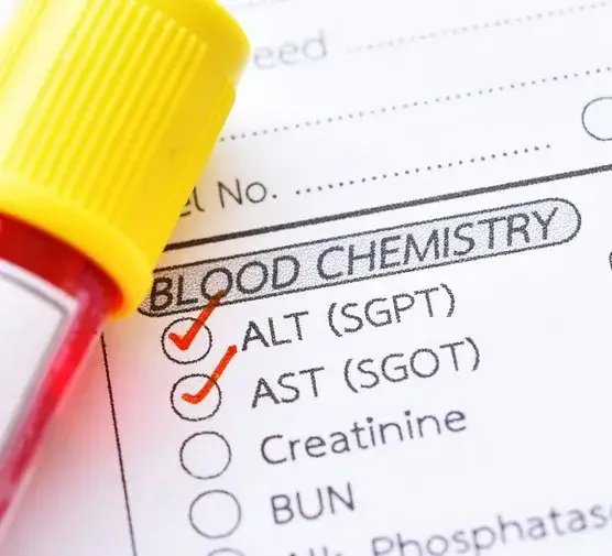 Badanie ALT: Co oznacza wynik i jak zadbać o wątrobę?
