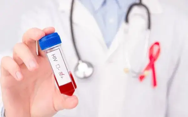 Leczenie HIV w Polsce: Czy jest bezpłatne? Pełna refundacja