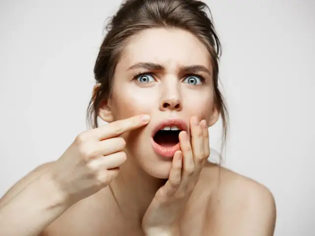 Bolesny pryszcz: Szybkie sposoby na ulgę i kiedy iść do dermatologa