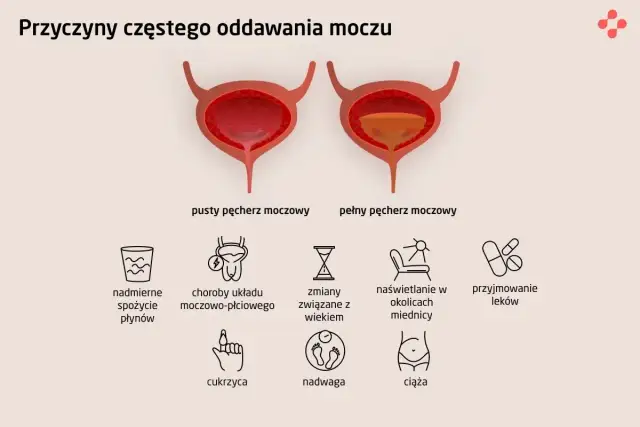 Ilustracja pokazuje przyczyny częstego oddawania moczu: nadmierne picie, choroby, wiek, nadwagę, ciążę i leki.