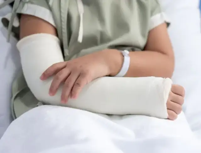 Złamanie łokcia ile gips – ile czasu musisz nosić gips?