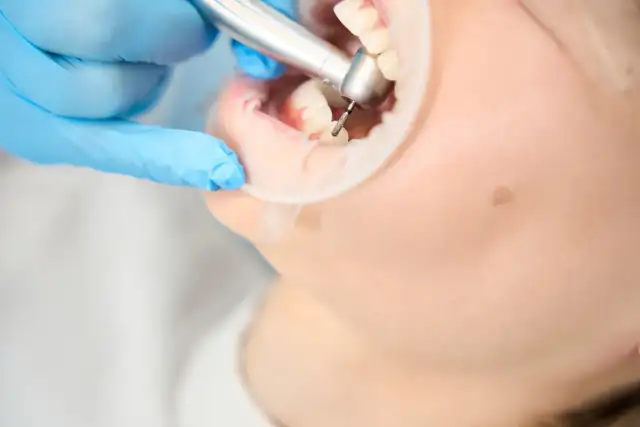 Ile trwa wizyta u dentysty? Poznaj czas trwania różnych zabiegów