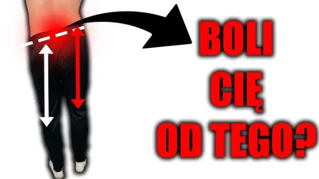 Jak zmierzyć długość nóg? Nierówność a ból pleców poradnik