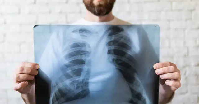 Jak oczyścić płuca ze smogu i poprawić zdrowie układu oddechowego