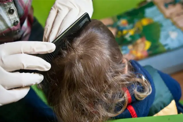 Pielęgniarka szkolna a wszawica: Co musisz wiedzieć o prawach rodzica?