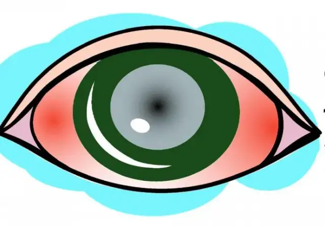 Czego nie można robić przy jaskrze, aby nie pogorszyć stanu oczu