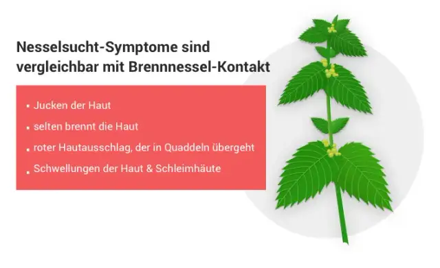 Medikamente gegen Nesselsucht: Effektive Lösungen für juckende Quaddeln