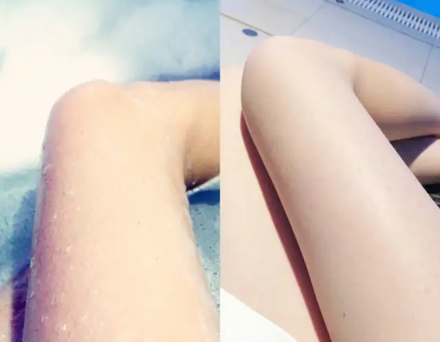 Jak skutecznie pozbyć się czerwonych kropek po goleniu i uniknąć podrażnień