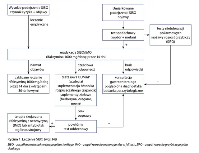 SIBO do jakiego lekarza? Kluczowe informacje dla pacjentów