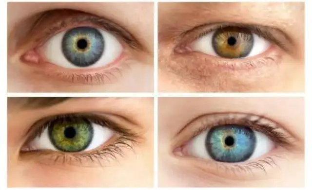 Zielony kolor oczu ile procent? Rzadkość i ciekawostki o zielonych oczach