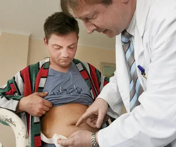 Jaki lekarz od woreczka żółciowego? Sprawdź, do kogo się zgłosić