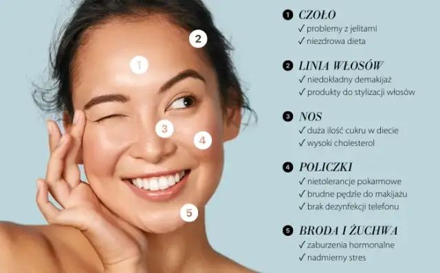 Pryszcze na czole: Skuteczne sposoby, składniki i co naprawdę działa?