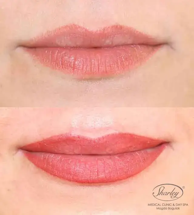 Makijaż permanentny ust: czy warto? Zalety, wady i opinie