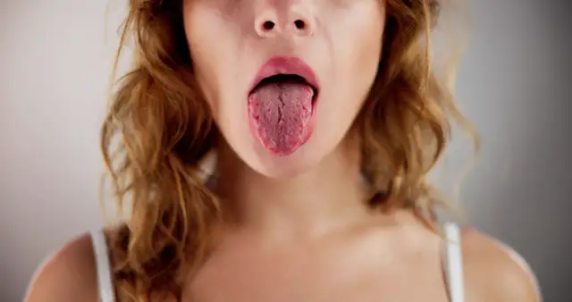 Suchość w jamie ustnej przyczyna: poznaj najczęstsze powody tej dolegliwości