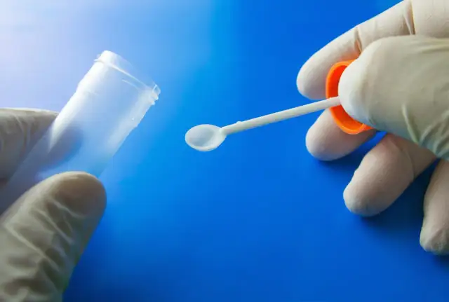 Ile kosztuje badanie kału w Sanepidzie? Sprawdź ceny i procedurę