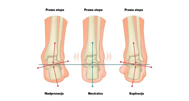 Jak stawiać stopę podczas biegania, aby uniknąć kontuzji i poprawić formę