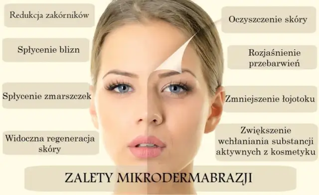 Mikrodermabrazja twarzy: Czy to klucz do Twojej idealnej cery?