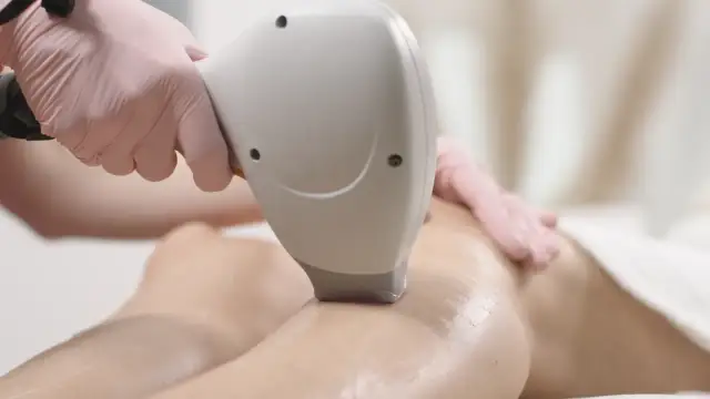 Depilacja laserowa: Jaki laser wybrać dla Twojej skóry i włosów?