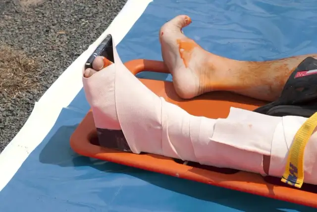 Skręcona kostka: Gdzie szukać pomocy? Poradnik krok po kroku