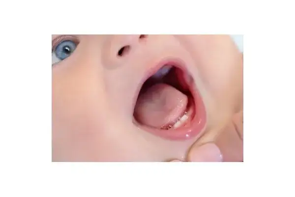 Dziąsła niemowlaka: ząbkowanie czy choroba? Rozpoznaj objawy!