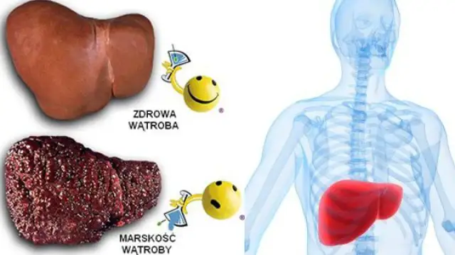 Czy wątróbka jest zdrowa? Poznaj jej korzyści i zagrożenia zdrowotne