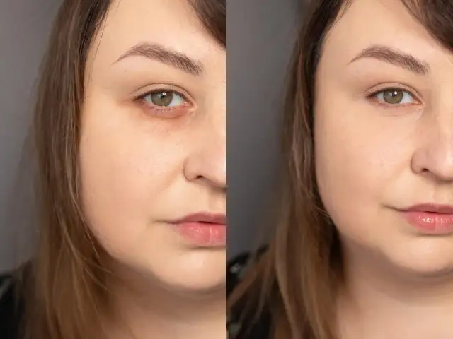 Porównanie twarzy: przed i po nałożeniu korektora pod oczy.