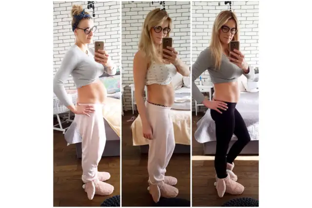 Fizjoterapia po CC: Kiedy zacząć i jak odzyskać ciało po cesarce?