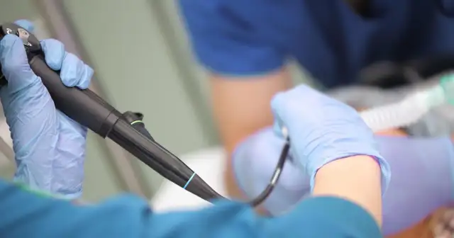 Lekarz w rękawiczkach przygotowuje się do gastroskopii. Czy gastroskopia boli? Znieczulenie i profesjonalizm lekarza minimalizują dyskomfort.