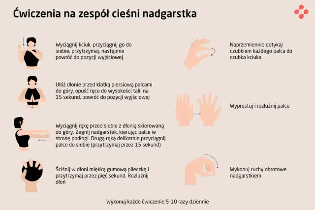 Ilustracja pokazuje ćwiczenia na zespół cieśni nadgarstka: rozciąganie, zginanie, dotykanie palców, ściskanie piłeczki i ruchy nadgarstkiem.