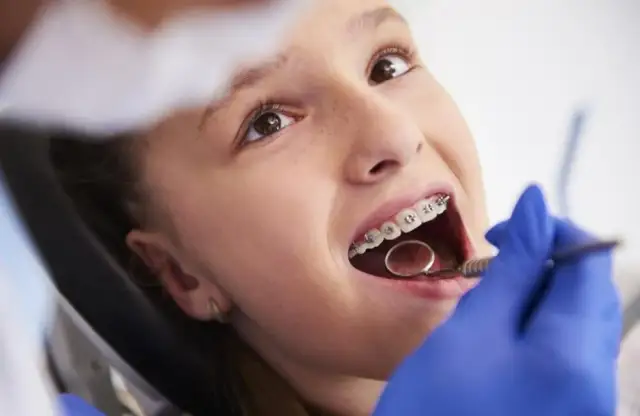 Ortodonta czy dentysta? Kto założy aparat na zęby?