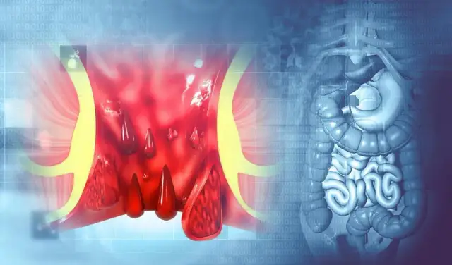 Selles rouges après betteraves : combien de temps cela dure-t-il ?
