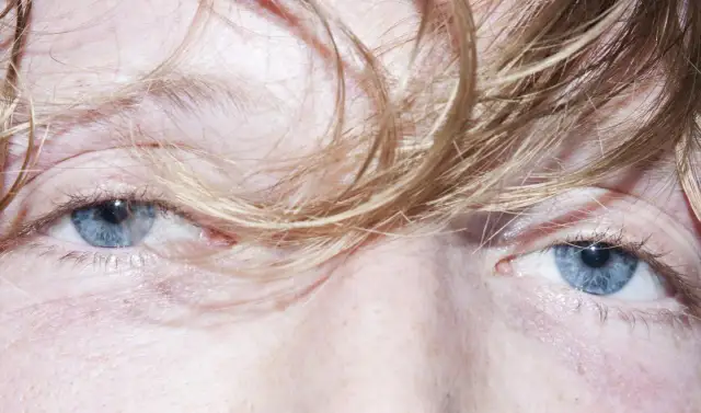 Oczy jak szpilki - co oznaczają rozszerzone źrenice i ich przyczyny