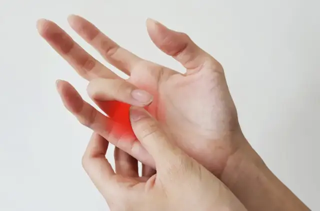 Przytrzasnąłeś palec? Szybka pomoc, ocena urazu i leczenie