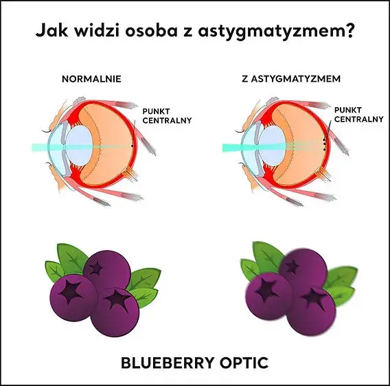 Astygmatyzm: plusy i minusy na recepcie? Zrozum swoją wadę!