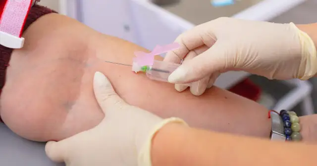 Wysokie limfocyty w morfologii: kiedy to sygnał infekcji, a kiedy alarm?