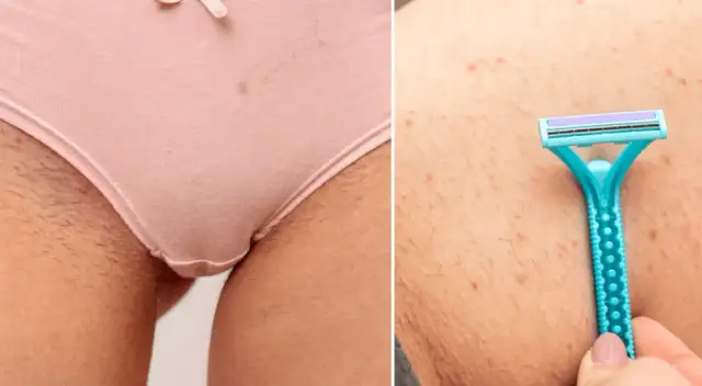 Golenie miejsc intymnych bez podrażnień? Krok po kroku!