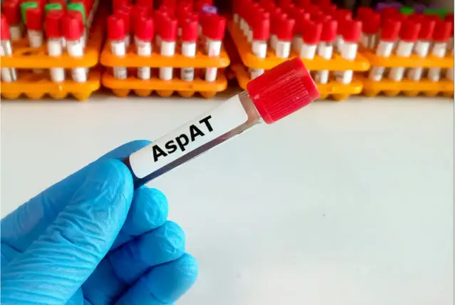 Co to jest AspAT w badaniu krwi i co oznaczają jego wyniki?