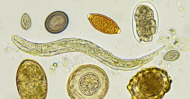 Jakie badania na pasożyty u dziecka? Kluczowe informacje i testy