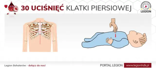Ile ucisków klatki piersiowej? Kluczowe zasady RKO dla każdego